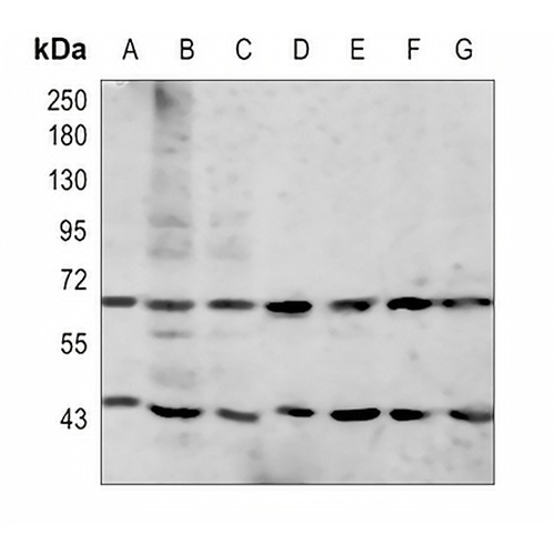 GAS6 Rabbit Polyclonal Antibody