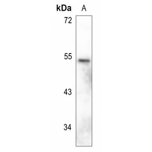 GFAP Rabbit Polyclonal Antibody