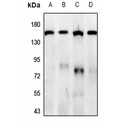 GPR158 Rabbit Polyclonal Antibody
