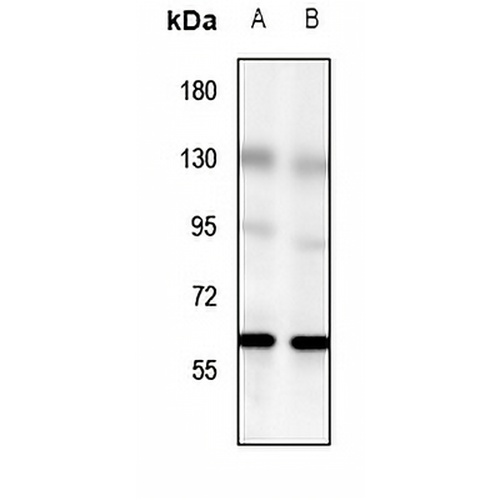 GPR56 Rabbit Polyclonal Antibody