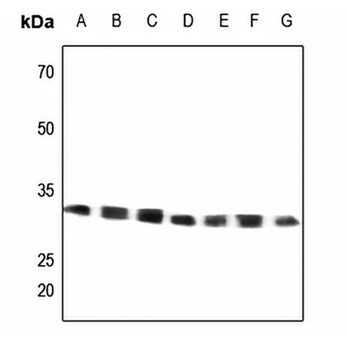 GRB2 Rabbit Polyclonal Antibody