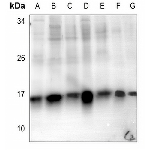 Histone H2B (Acetyl-K5) Rabbit Polyclonal Antibody