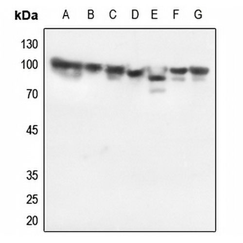 HSP90 beta Rabbit Polyclonal Antibody