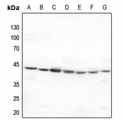 5-HT1F Rabbit Polyclonal Antibody