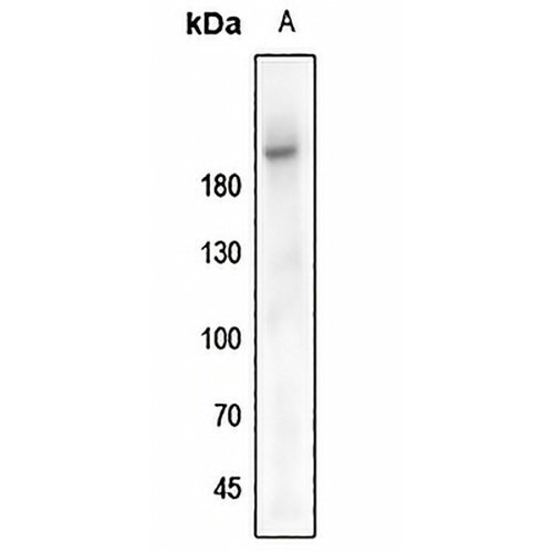 IGF1 Receptor (Phospho-Y1161) Rabbit Polyclonal Antibody