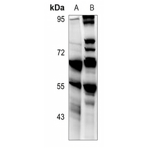 CD213a2 Rabbit Polyclonal Antibody