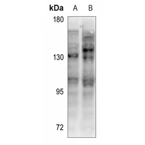 CD130 Rabbit Polyclonal Antibody