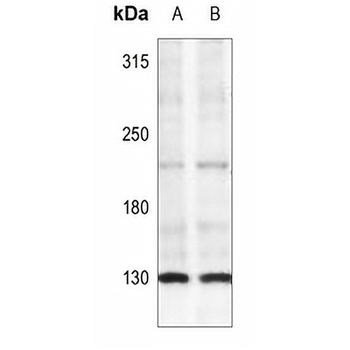 IRS1 (Phospho-S307) Rabbit Polyclonal Antibody