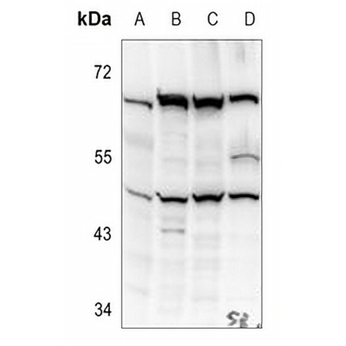 Kir2.1 Rabbit Polyclonal Antibody