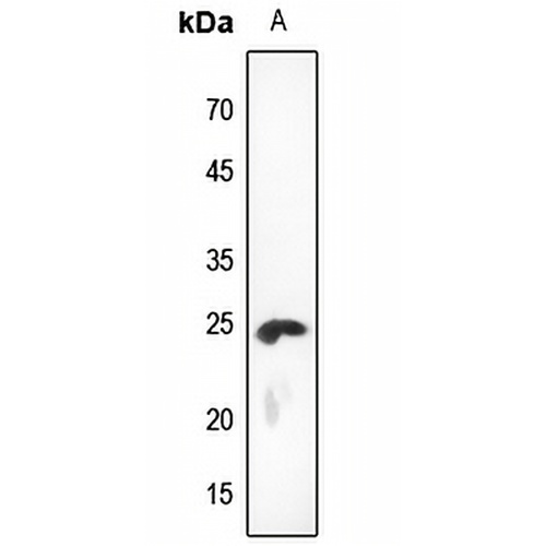 KDELR2 Rabbit Polyclonal Antibody