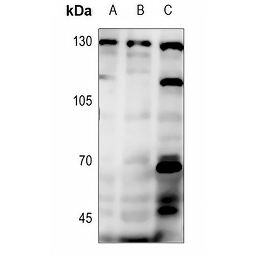 PRKD1/2/3 (Phospho-S738/S742) Rabbit Polyclonal Antibody