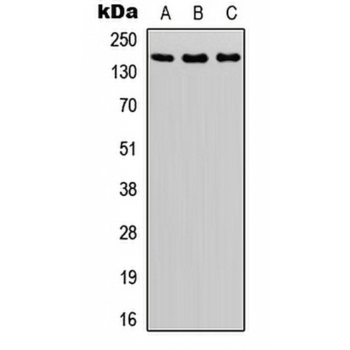 ASK1 (Phospho-S966) Rabbit Polyclonal Antibody