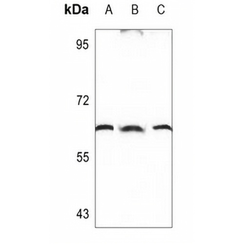 TPL2 Rabbit Polyclonal Antibody