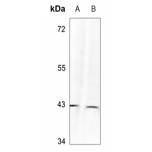 p38 (Phospho-Y323) Rabbit Polyclonal Antibody