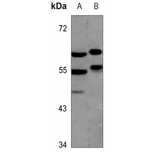 MEF2A Rabbit Polyclonal Antibody