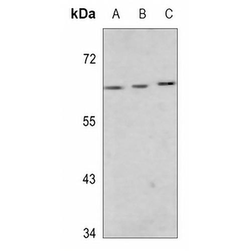 MEF2D (Phospho-S444) Rabbit Polyclonal Antibody