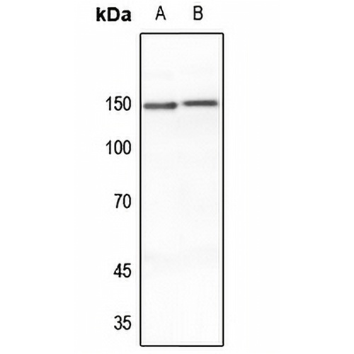 MEKKK6 Rabbit Polyclonal Antibody