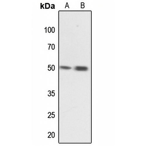 MNK1 Rabbit Polyclonal Antibody