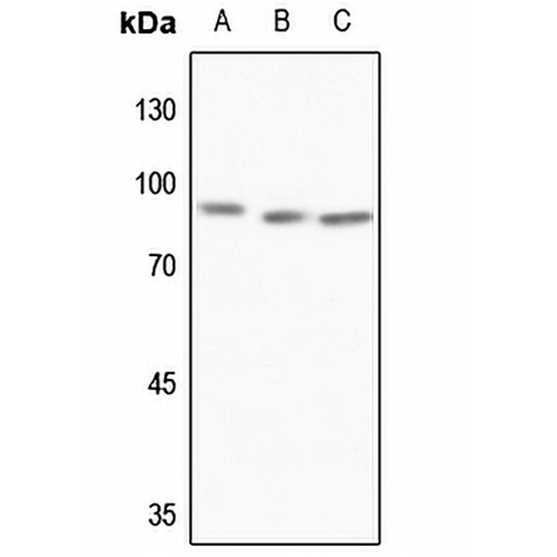 MTA1 Rabbit Polyclonal Antibody