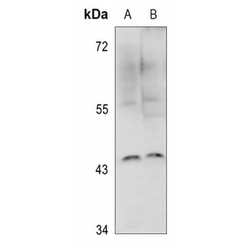 IKB epsilon Rabbit Polyclonal Antibody