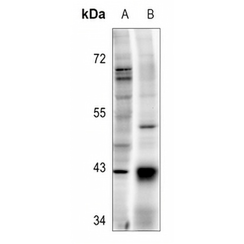 TOPK (Phospho-T9) Rabbit Polyclonal Antibody