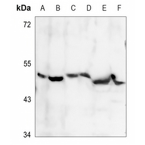 PDK2 Rabbit Polyclonal Antibody