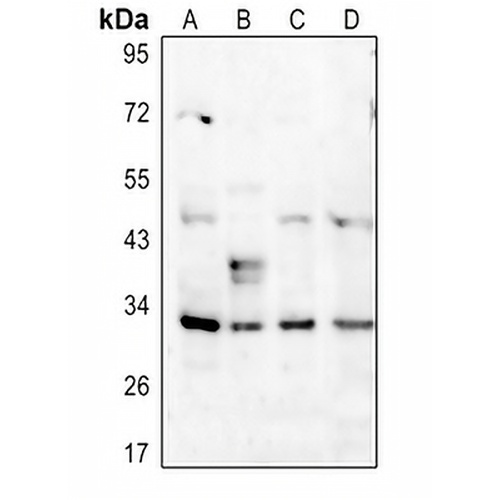 DARPP32 (Phospho-T34) Rabbit Polyclonal Antibody