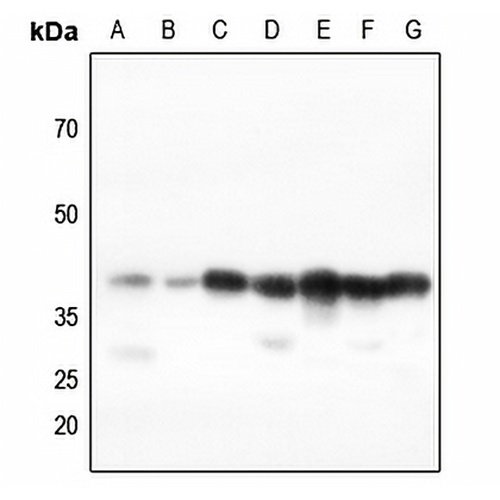 AMPK beta 1 Rabbit Polyclonal Antibody