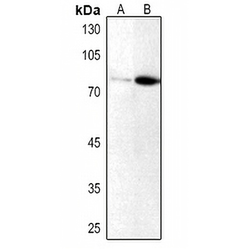 PKC iota/zeta (Phospho-T412/410) Rabbit Polyclonal Antibody