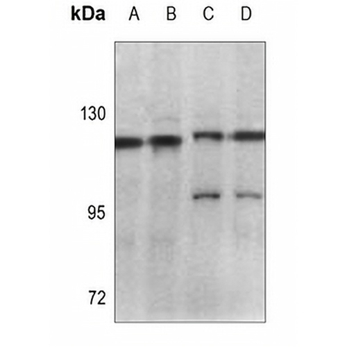 Focal Adhesion Kinase Rabbit Polyclonal Antibody