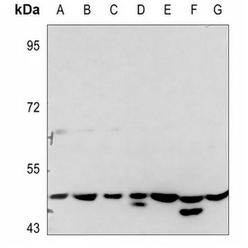 PTX3 Rabbit Polyclonal Antibody
