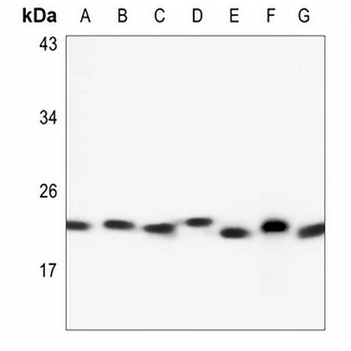 RAB6A Rabbit Polyclonal Antibody