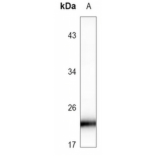 RAB8B Rabbit Polyclonal Antibody