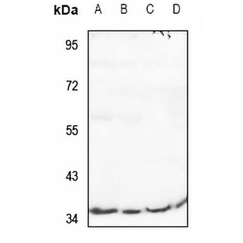 RIMKLB Rabbit Polyclonal Antibody