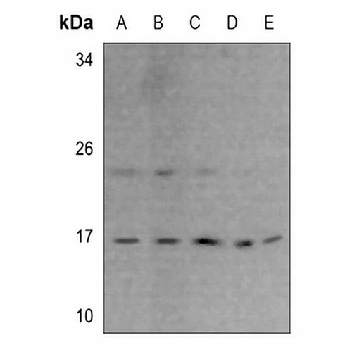 RPS23 Rabbit Polyclonal Antibody