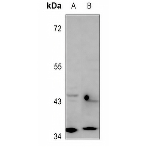 RagA/B Rabbit Polyclonal Antibody