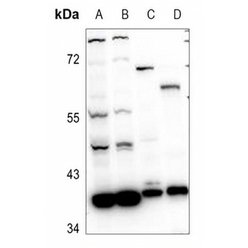 RRM2B Rabbit Polyclonal Antibody