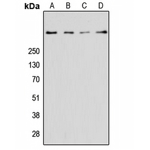 Ryanodine Receptor 2 Rabbit Polyclonal Antibody