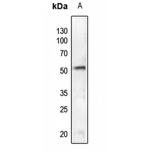 SGK1 (Phospho-S78) Rabbit Polyclonal Antibody