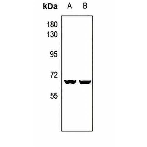 CAT4 Rabbit Polyclonal Antibody