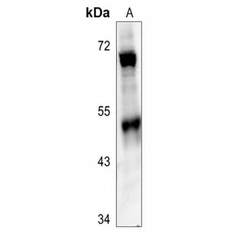 SMYD2 Rabbit Polyclonal Antibody