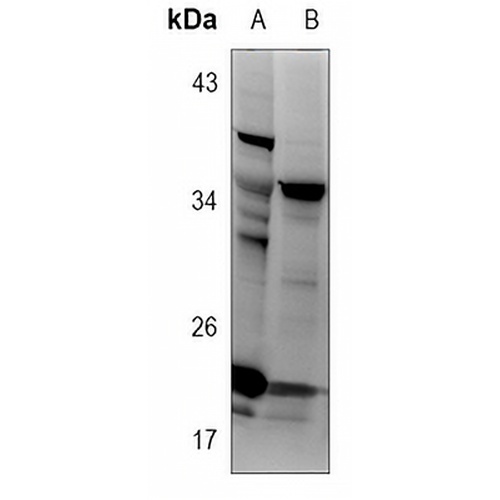 Alpha-synuclein Rabbit Polyclonal Antibody