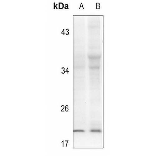 Alpha-synuclein (Phospho-Y133) Rabbit Polyclonal Antibody