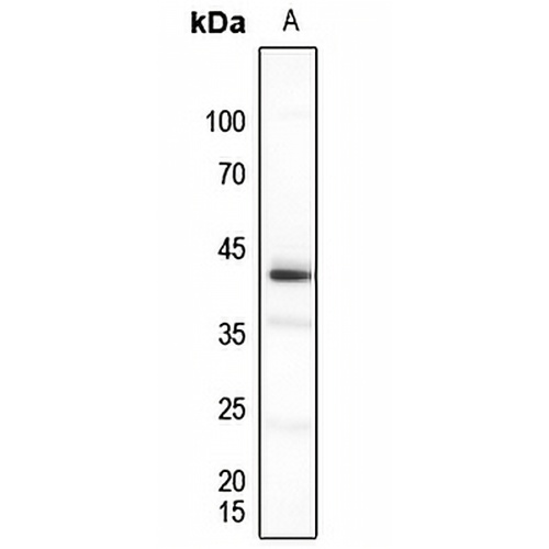 PU.1 Rabbit Polyclonal Antibody