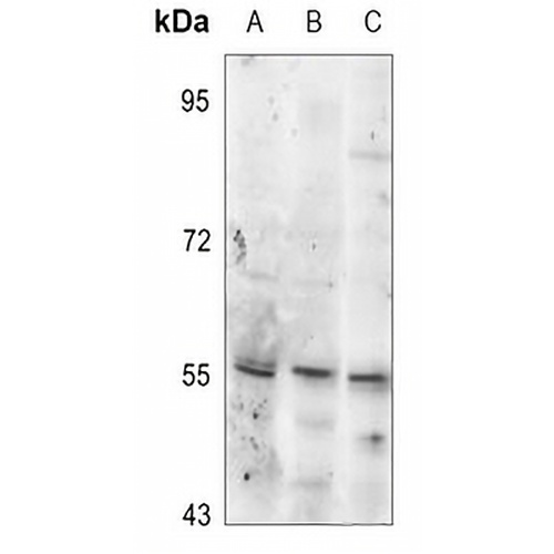 Tyrosine Hydroxylase (Phospho-S19) Rabbit Polyclonal Antibody