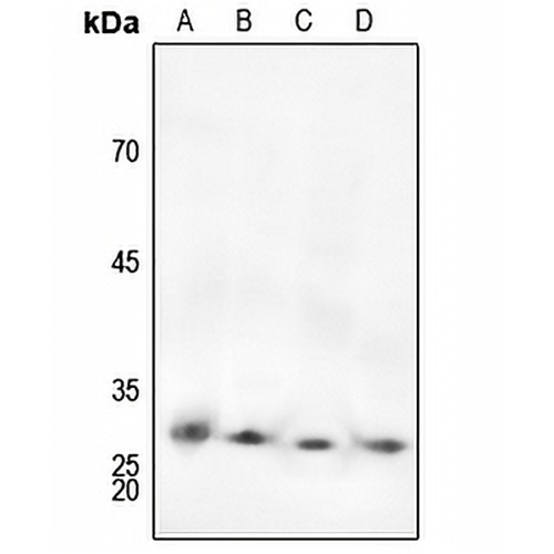 cTnI (Phospho-S22/S23) Rabbit Polyclonal Antibody