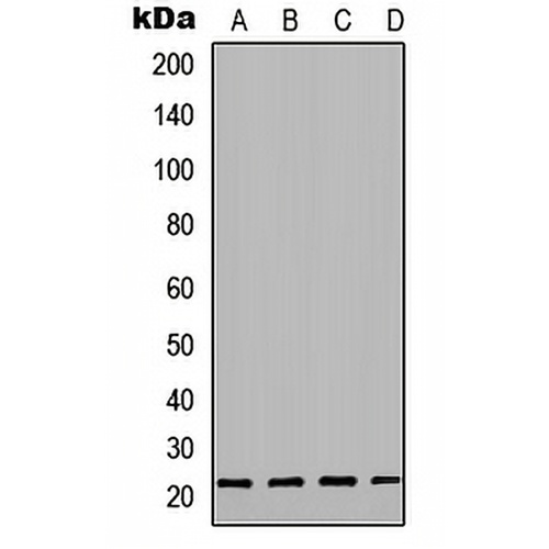 sTnT Rabbit Polyclonal Antibody