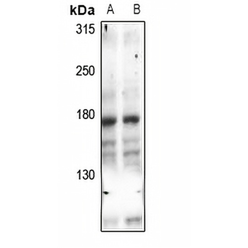 UBR1 Rabbit Polyclonal Antibody
