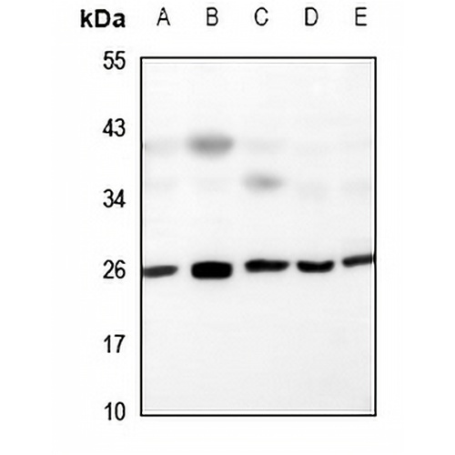 UBTD2 Rabbit Polyclonal Antibody