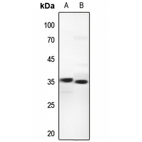 UCP3 Rabbit Polyclonal Antibody